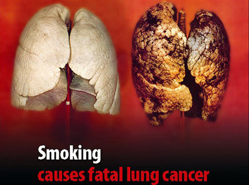 吸烟对家庭和家人的危害